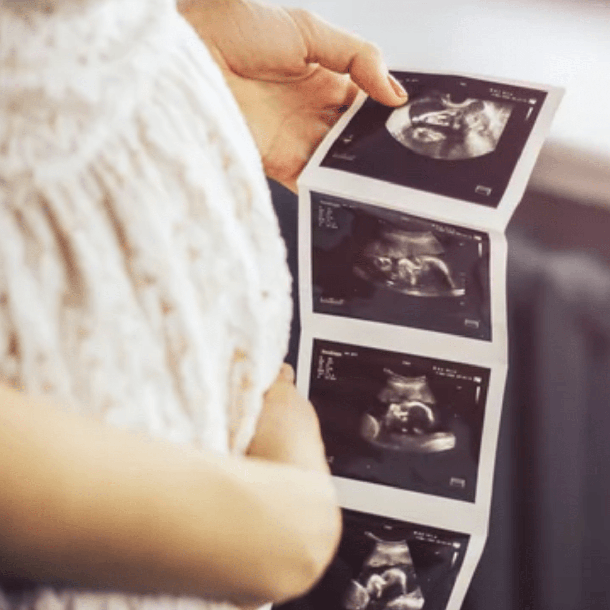 エコー写真を上手に撮影する方法を詳しく解説 - Stella Mimore